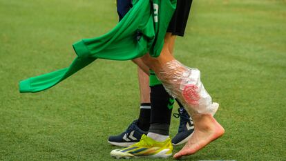 La pierna de Isco con hielo al abandonar el estadio de Gran Canaria en el duelo del Betis ante Las Palmas.