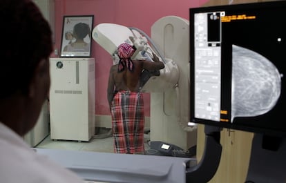 Una paciente del Hospital Nacional Kenyatta en Nairobi (Kenia) se somete a una mamografía.