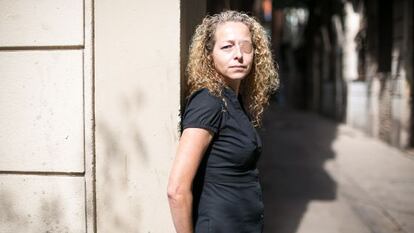 Ester Quintana, 42, lost an eye during a street protest in Barcelona.