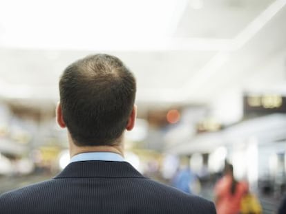 Diez cosas sobre la caída de cabello que (quizás) desconocías