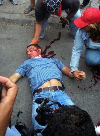 Un manifestante herido de un disparo en la cabeza yace en la calle el jueves en Tegucigalpa.