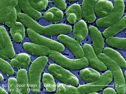 A microscope's view of the bacteria 'Vibrio vulnificus.'