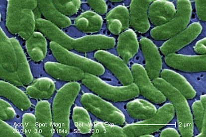 A microscope's view of the bacteria 'Vibrio vulnificus.'