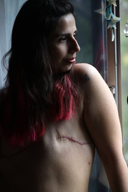 Sandra posa para una fotografía el 1 de octubre de 2021, en la Ciudad de México, meses después de que se le practicara una masectomía bilateral.