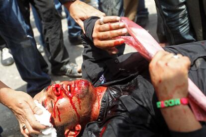 Manifestantes ayudan a un herido durante los choques en el barrio de Abasiya, El Cairo.