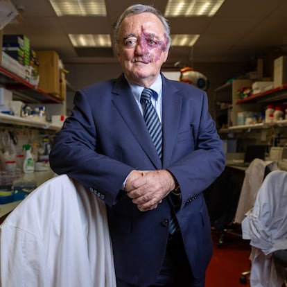 Estudio de Barbacid cáncer de páncreas