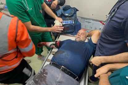 El corresponsal de Al Jazeera Wael al Dahdouh es atendido en un hospital de Gaza tras resultar herido durante un ataque israelí el 15 de diciembre.