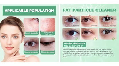 How to remove milia from face? This scrub is ideal.