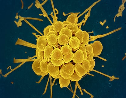 Gepotidacina para bacteria de la gonorrea
