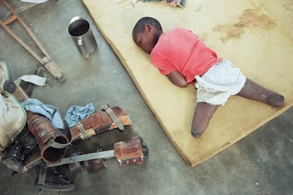 Un niño huérfano, con las piernas amputadas por debajo de la rodilla, descansa sobre una colchoneta en un orfanato de Nyanza, al suroeste de Kigali (Ruanda), el 9 de junio de 1994.