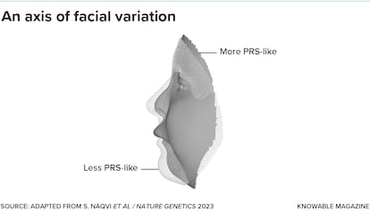 Pierre Robin sequence (PRS) is a craniofacial disorder characterized in part by a small lower jaw and caused by a mutation in the regulatory gene SOX9. Researchers sorted normal faces according to how much or how little they resembled the features of PRS, and then looked for associated gene variants. The researchers found that some genes are very sensitive to SOX9, dialing facial variation toward or away from PRS-like facial features. If other axes of facial variation are determined in a similar way, this could mean that the genetics of faces may be simpler than they seem.