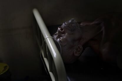 Alfred Wani reposa en una cama de la clínica del campo de refugiados de Impevi, al norte de Uganda. Alfred se encontraba mal durante la noche y se le tuvo que extraer sangre.