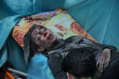 Una mujer herida en un bombardeo israelí espera atención médica en un centro sanitario del sur de la Franja de Gaza.
