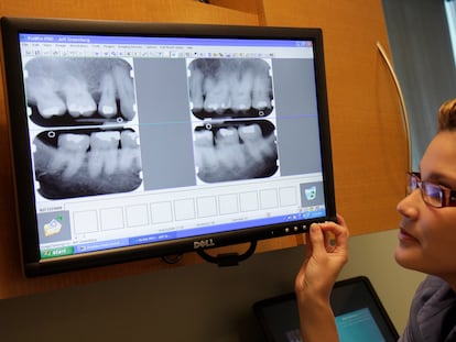 Una asistente de una clínica dental mira una radiografías que muestran periodontitis.