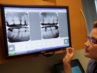 A dental clinic assistant looks at an x-ray that shows periodontitis.