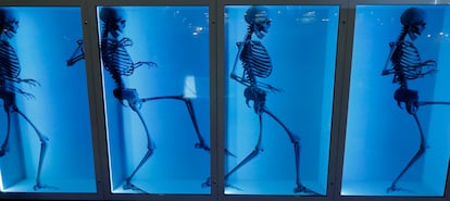 Imágenes de un esqueleto proyectadas en un monitor con tecnología LCD en la feria GoTech World 2023, el pasado 9 de noviembre en Bucarest.