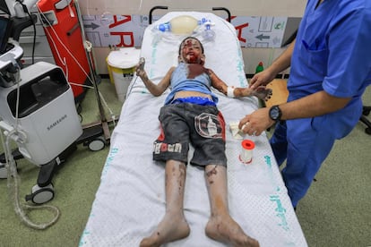 Sanitarios atendían a un niño palestino herido tras un ataque israelí, el lunes, en el hospital de Jan Yunis. 