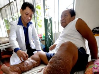 Un m&eacute;dico trata a un paciente infectado con filariasis en Filipinas.