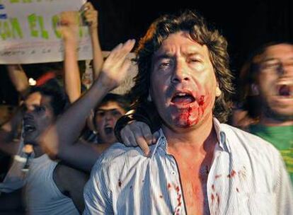 Un manifestante antigubernamental, herido por piqueteros, continúa su protesta cerca de la Plaza de Mayo.