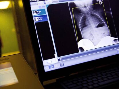 Un técnico revisa una radiografía en el Centro Médico Regional Upson, Thomaston, Estados Unidos.
