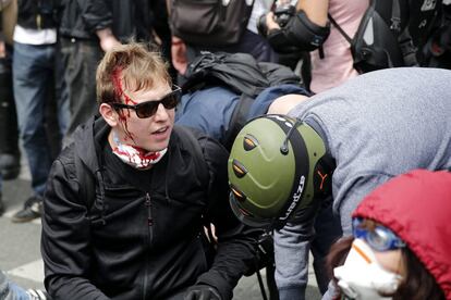 Uno de los manifestantes que se oponen a la reforma laboral del Gobierno herido durante los disturbios con la policía en París.