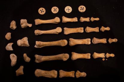 Conjunto de botones de ropa y huesos de una mano hallados entre los restos humanos encontrados en el templo de San Francisco Javier ubicado en el centro histórico de la ciudad de Puebla. 