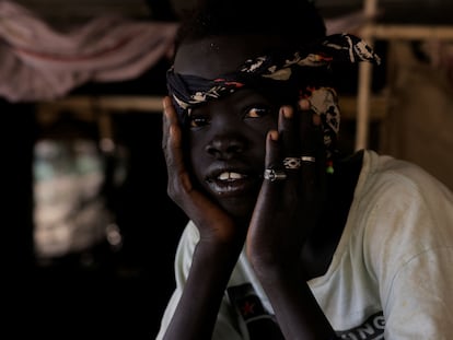 Un niño sursudanés vive en un refugio improvisado. Sudán del Sur ocupa la última posición en la clasificación de desarrollo humano de la ONU.