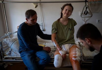 Nastia reacciona al dolor mientras se somete a una sesión de rehabilitación en un hospital público en Kiev, Ucrania, el miércoles 4 de mayo de 2022.  