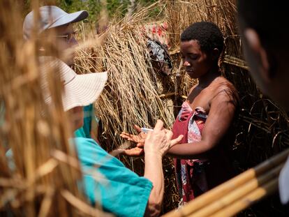 Los dermatólogos Víctor Dios y Águeda Pulpillo de Dermalawi realizan una segunda prueba de detección de lepra para constatar si la paciente tiene sensibilidad en las manos y pies.