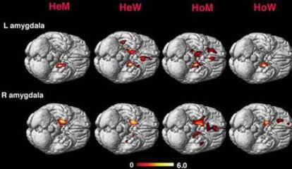 Variaciones en la amígdala cerebral según la orientación sexual.