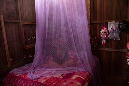 Valentina Esperanza, que se está recuperando del dengue, sentada en su cama protegida con mosquitera mientras ve un programa de televisión en su casa de Pucallpa, en la región Ucayali de Perú.