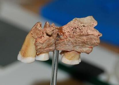 Maxilar con tres dientes descubierto en una cueva en Devon (Reino Unido) en 1927 y ahora identificado como el resto de la especie humana moderna más antiguo de la Europa noroccidental.