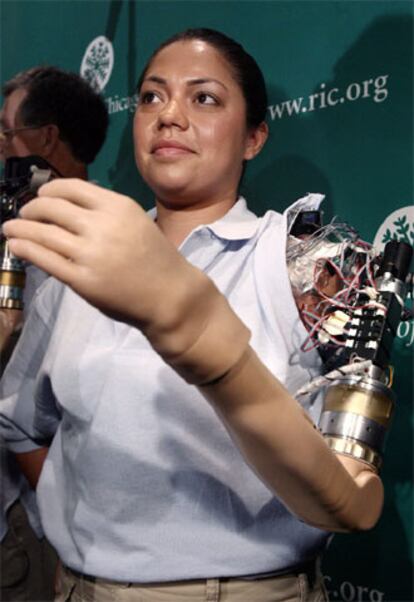 Claudia Mitchel, durante la presentación del brazo binónico en Washington.