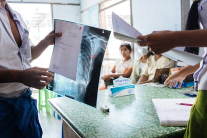 Un paciente recolecta radiografías en la clínica de tuberculosis del Hospital General de Mandalay. Cuando se lanzó en 2005, el Programa IHC se limitó a ayudar a los pacientes coinfectados con tuberculosis y VIH en Mandalay. Ahora apoya al 22% de todas las personas que viven con el VIH en Myanmar. 