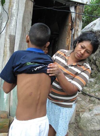 El niño Ángel David, al que la policía disparó en la espalda.