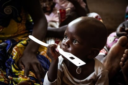 Por primera vez en una década, el hambre aumentó este 2020, según el informe más importante que la ONU publicada cada año. A finales de 2020, entre 720 y 811 millones de personas no sabían si al día siguiente tendrían algo que llevarse a la boca. En un centro de salud especializado en atender a hambrientos de Camerún, los números de los informes se constatan echando un vistazo.