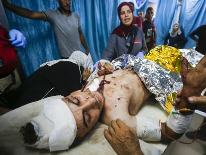Palestinos heridos son trasladados al Hospital de los Mártires de Al-Aqsa para recibir tratamiento tras el ataque israelí al área de Al Mughraqa, en Deir al-Balah, Gaza, el 12 de junio de 2024.
