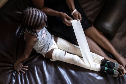 Una mujer venda las piernas de una niña en el Centro Nacional de Rehabilitación de Freetown el 20 de abril de 2022.