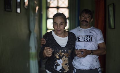 Yamile sofre de Alzheimer precoce. Na foto, é ajudada por seu esposo, Hildebrando.