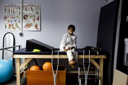 Abdallah (nombre ficticio) de 12 años, sufrió una fractura grave en una de sus piernas en un accidente de coche. En la imagen realiza sus ejercicios de fisioterapia en una sala equipada con aparatos de rehabilitación del hospital de Kunduz el 29 de noviembre de 2011.  