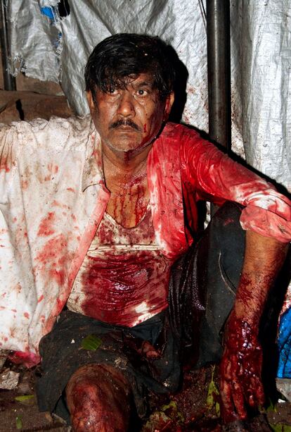 Un herido, ensangrentado, tras la explosión en el Opera House de Bombay.