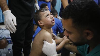 Un niño herido en un ataque israelí es atendido en el hospital Al Aqsa de Deir el Balah en Gaza.