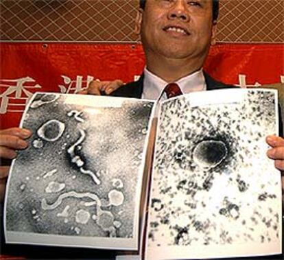 John Tam, microbiólogo de la Universidad China de Hong Kong, muestra imágenes del virus.