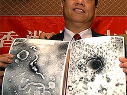John Tam, microbiólogo de la Universidad China de Hong Kong, muestra imágenes del virus.