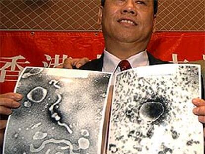 John Tam, microbiólogo de la Universidad China de Hong Kong, muestra imágenes del virus.