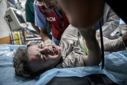 Un niño palestino es atendido en el hospital Nasser tras un ataque israelí en Jan Yunis, en la franja de Gaza. 