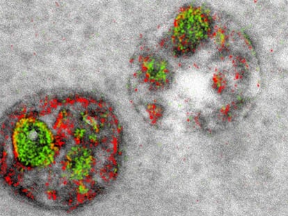 Imagen multicolor tomada con un microscopio electrónico.