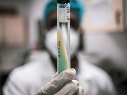 Muestra de tuberculosis que sujeta un técnico de laboratorio del Centro de Investigación en Salud de Manhiça, en Mozambique.