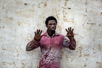 Abdourahman Giallo, 23 años de Guinea Conakry muestra las heridas tras intentar saltar la valla que separa Melilla de Marruecos el 15 de enero de 2014.