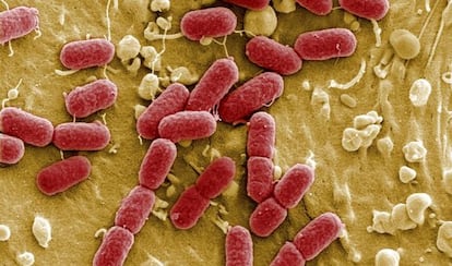 Grupo de bacterias Escherichia coli.